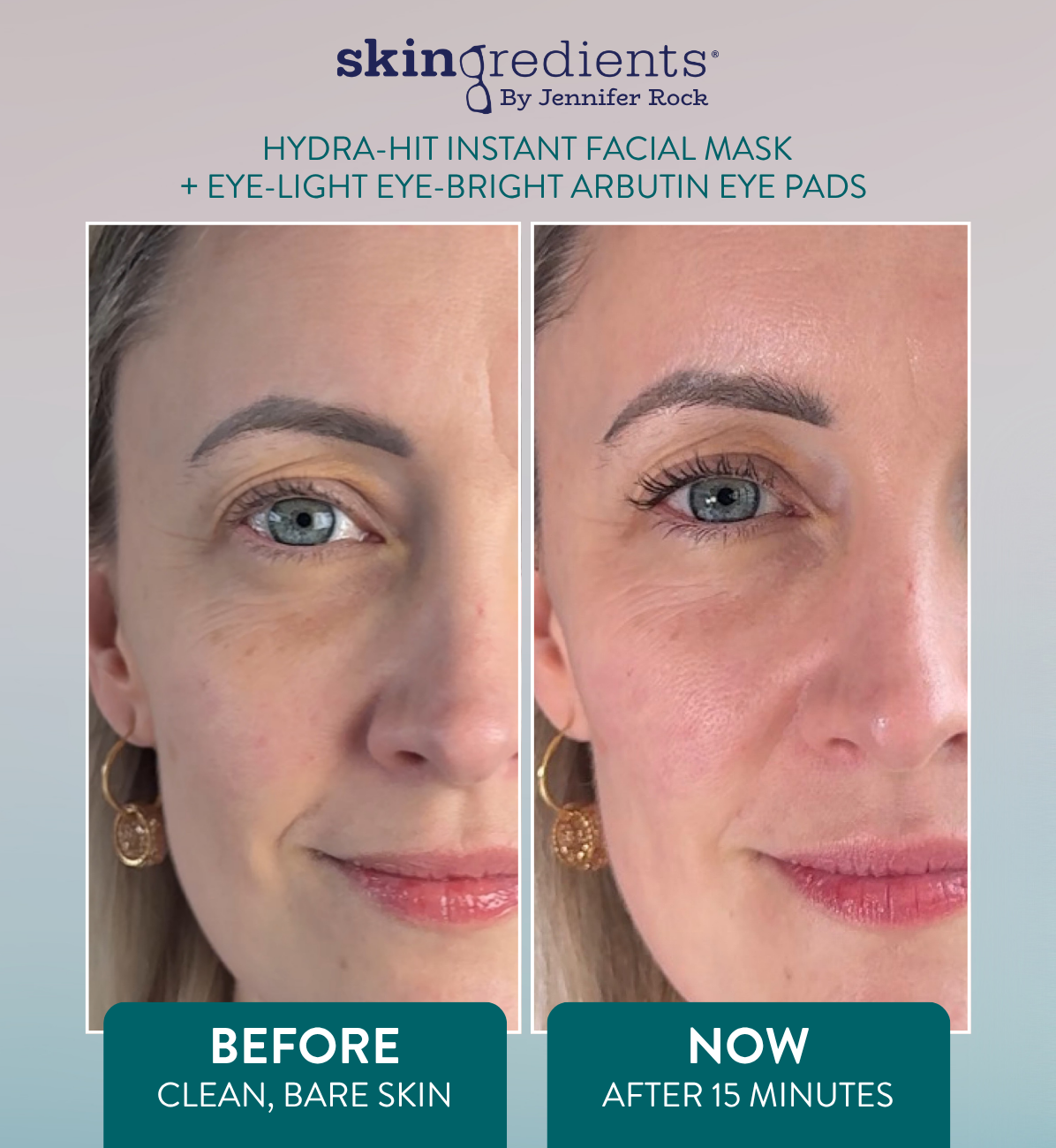 Skingredients Eye-Light Eye-Bright Under-Eye Pads – Hydrating Eye Pads for Dark Circles & Puffiness