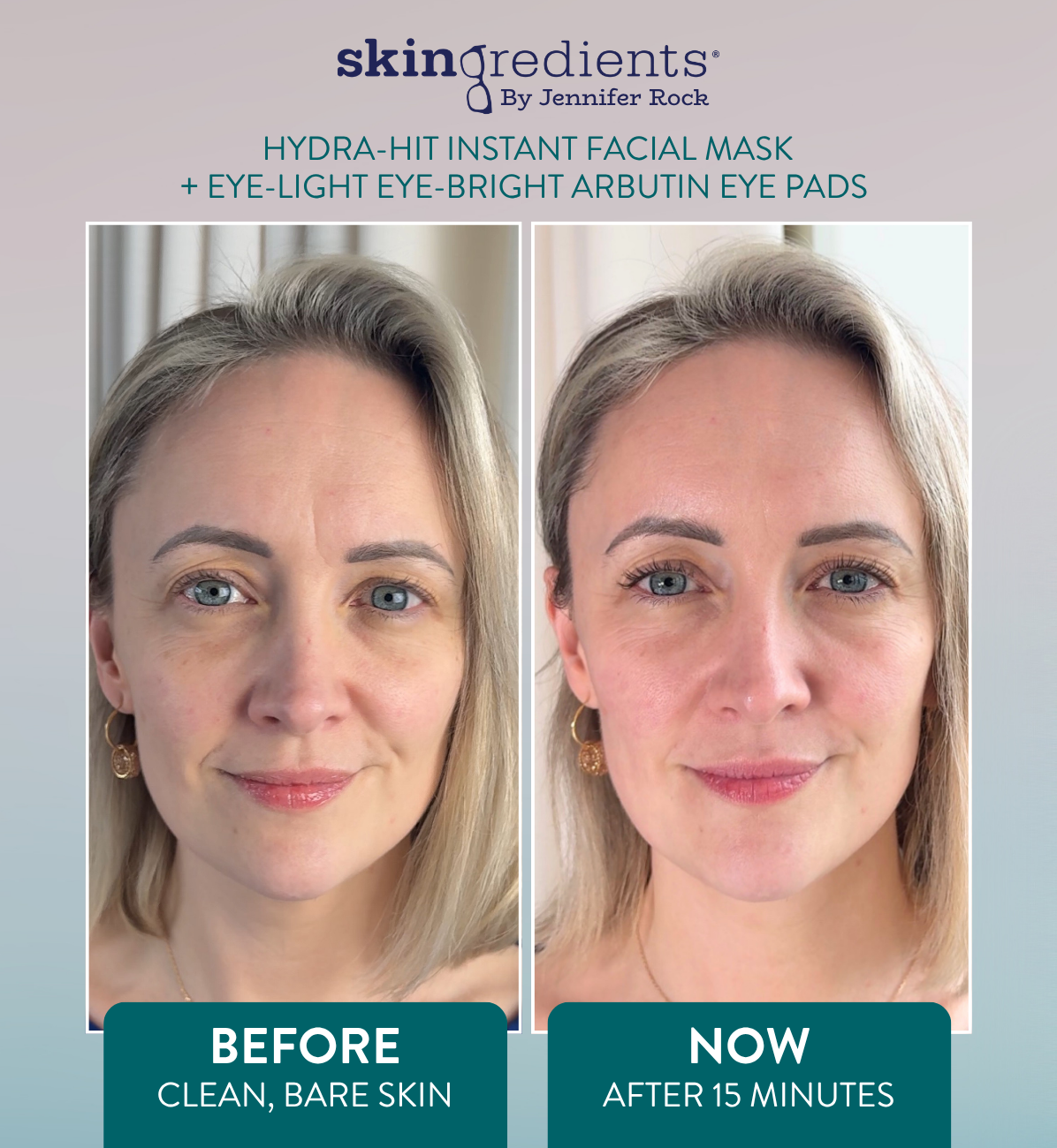 Skingredients Eye-Light Eye-Bright Under-Eye Pads – Hydrating Eye Pads for Dark Circles & Puffiness