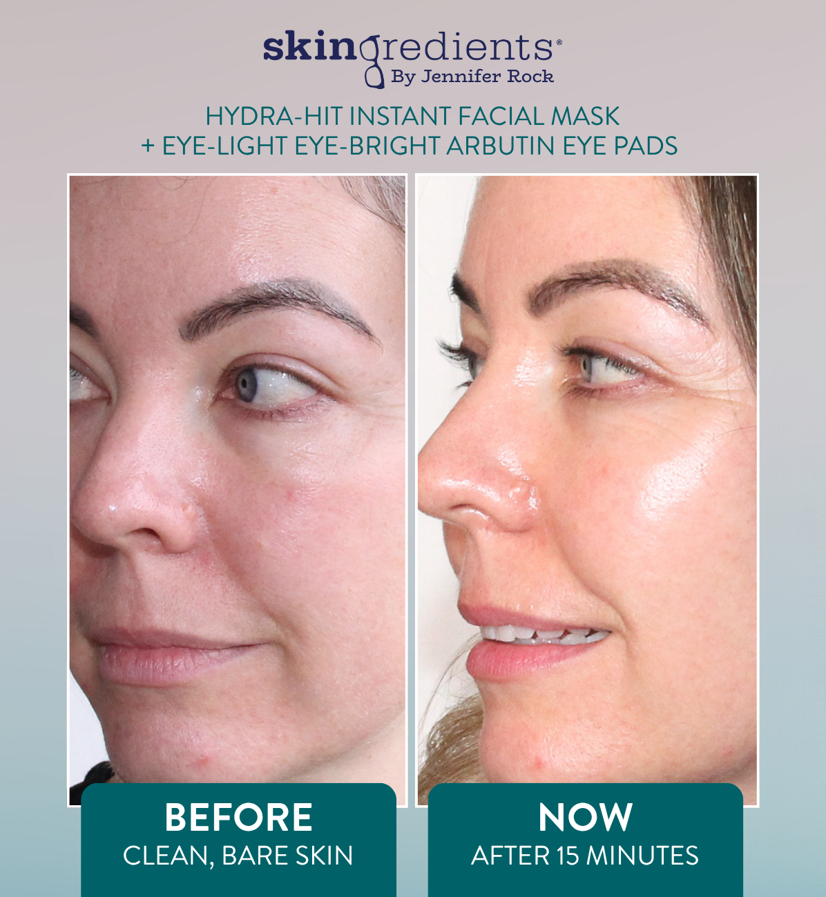 Skingredients Eye-Light Eye-Bright Under-Eye Pads – Hydrating Eye Pads for Dark Circles & Puffiness