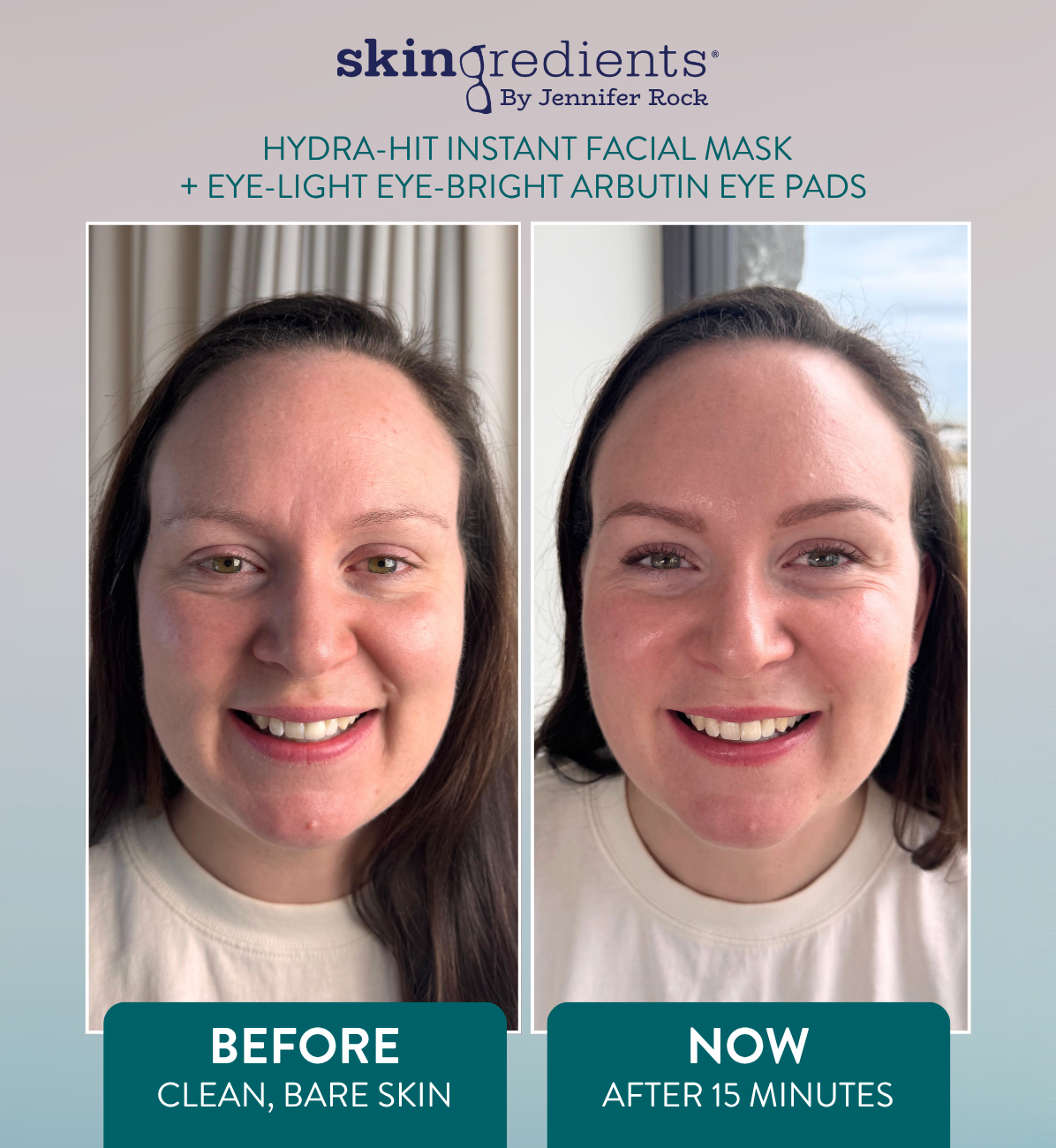 Skingredients Eye-Light Eye-Bright Under-Eye Pads – Hydrating Eye Pads for Dark Circles & Puffiness