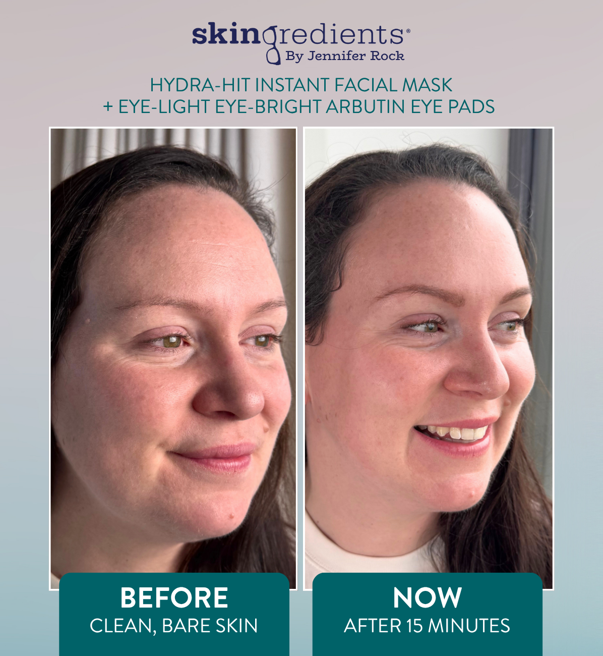 Skingredients Eye-Light Eye-Bright Under-Eye Pads – Hydrating Eye Pads for Dark Circles & Puffiness
