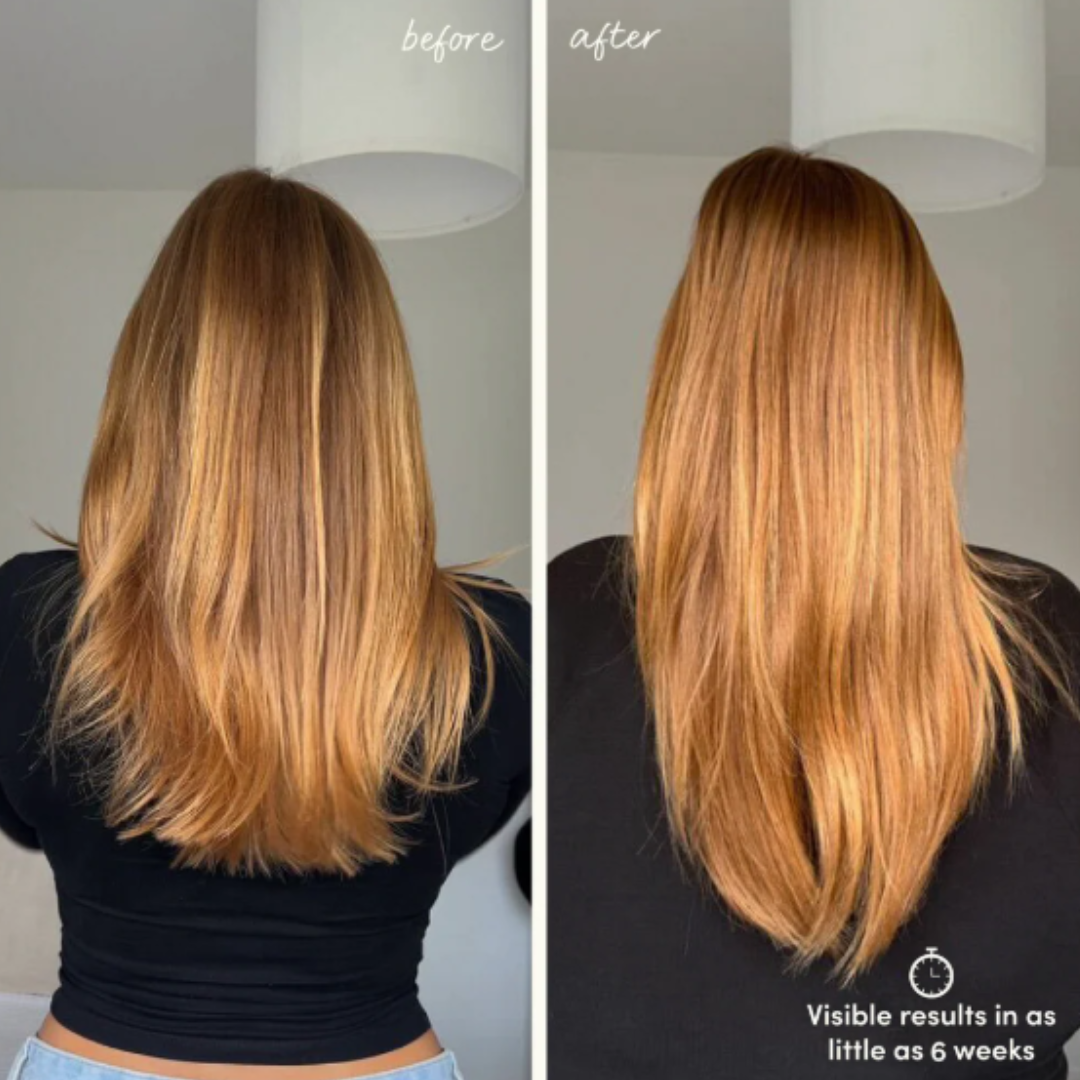 Glow For It Hair Growth Serum