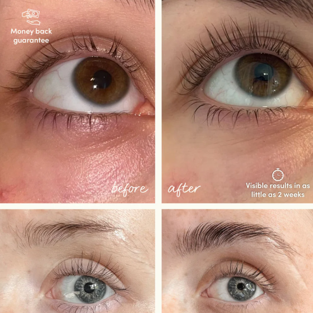 Glow For It Growth Starter Kit