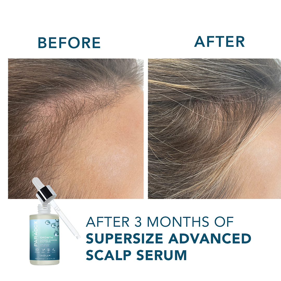 We Are Paradox Growth Advanced Scalp Serum 50ml